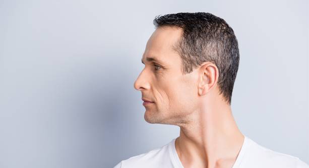 Male hair restoration