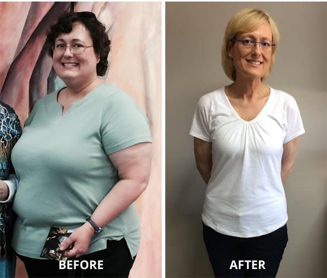 Before and after weight loss success story woman