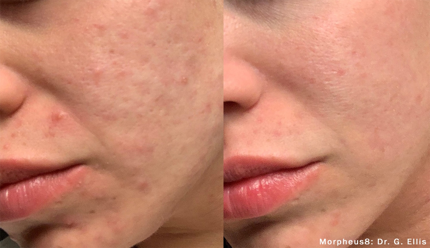 Before and after skin treatment results